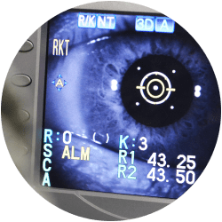 ContactLensSupervision